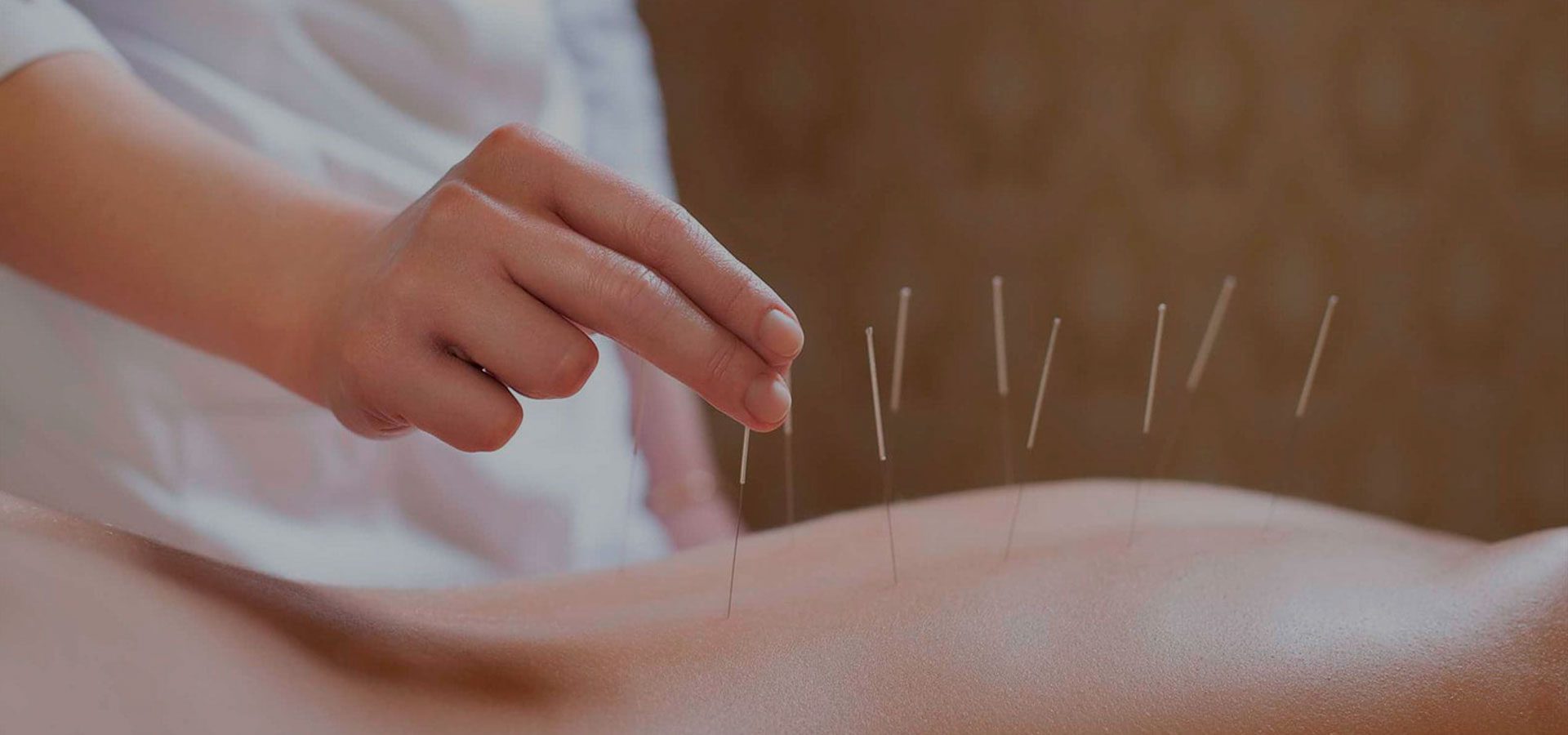 header-acupuncture