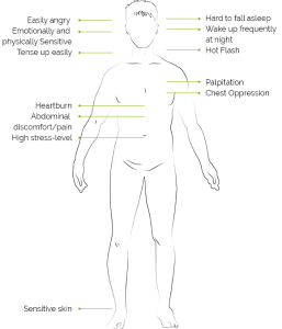 اضطراب 